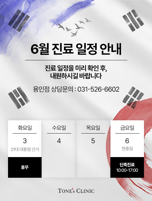 팝업